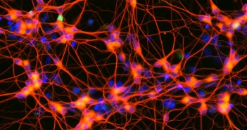 master_neuroni_sinapsi